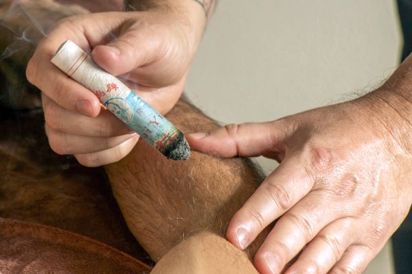 Moxibustion